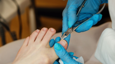 ingrown toenail doctor